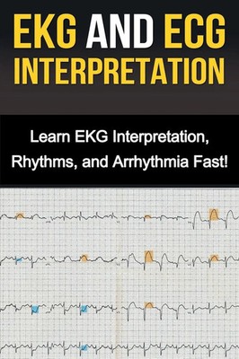 Alyssa Stone | EKG and ECG Interpretation | Taschenbuch | Englisch (2019)