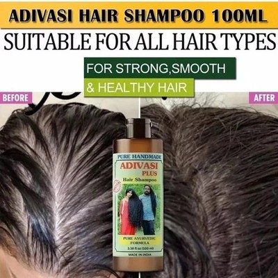 Tgideas Organic Rosemary Hair Growth Shampoo for Women and Men-Natural Thick