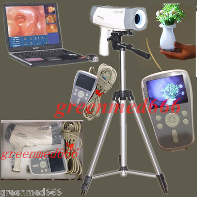 CE Electric Colposcope video Carema 800,000 pixels Color LED Handle +Tripod