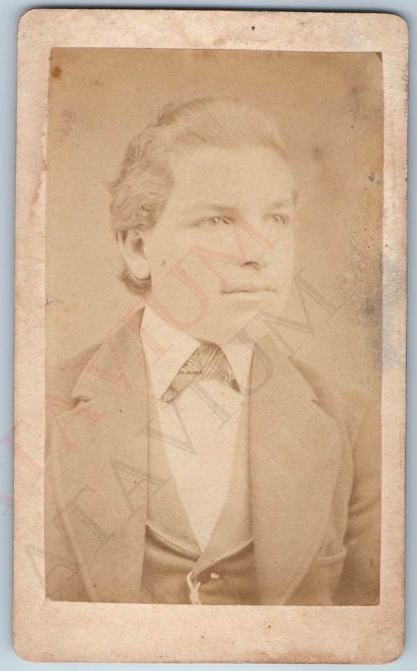 c1870s Fort Scott KS Large Head Young Man CDV Real Photo JT Parker Ft
