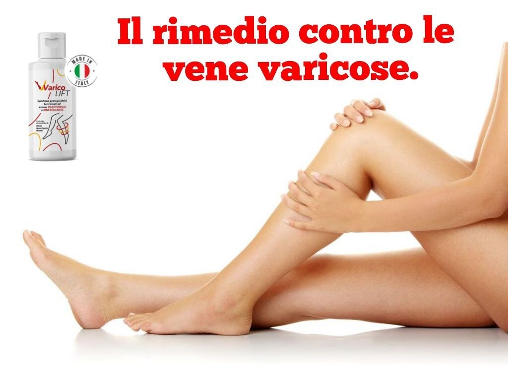 Foto 2 di 6