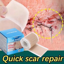 5/10PCS MEDICAL GRADE Scar Sheet Silicone Gel Tape Scar Removal Strips Treatment