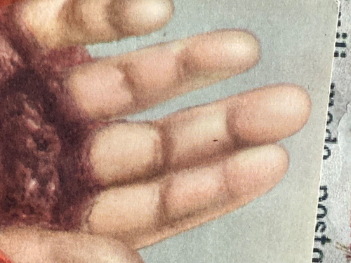 RARE ex-voto Padre Pio's stigmata: for grace received with bronze cross - 1970's - Picture 3 of 8