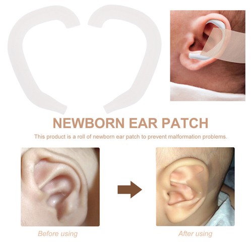 6 Pairs Aesthetic Ear Patch Protruding Ear Correctors Ear Auricle Valgus Sticker - 第 2/9 張圖片