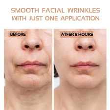 256Pcs Face Wrinkle Patches-Clear Reusable Pads for Overnight Anti-Wrinkle Treat