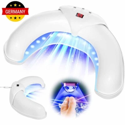 MARKENLOS Nagelpilz Laser Gerät schnelle Reparatur von Zehen Pilz Onychomykose Behandlung