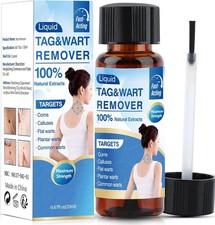 Wart Remover Liquid Skin Tag Mole Remover Eliminate Foot Corn Warts Unisex 20ML