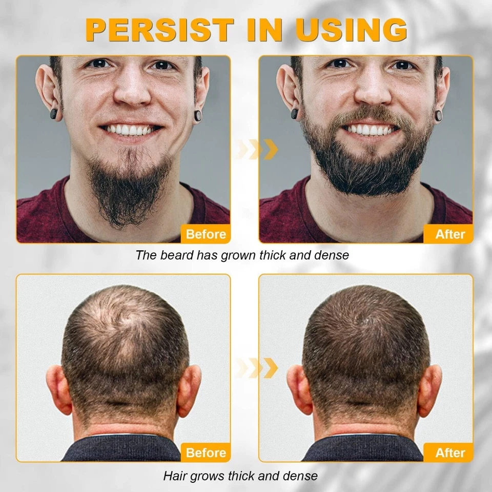Kit de crecimiento avanzado Beard Club cabello completo saludable hombres novios aceite suero potencia Foto 4 de 4