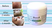 MiramaX Skincare Acne Fruit Acid Smoothing Cream 60 gramm for All Skin Types