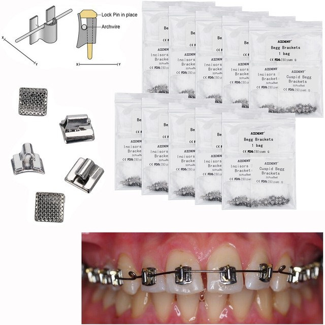 Dental Orthodontic Molar Band Archwire Niti Coil Elastic Begg Brace