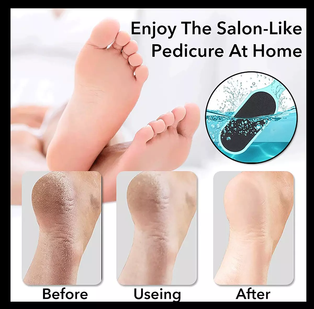 Feet Dead Skin Remover(Double-Sided Hard Dead Skin Callus Remover)- HDS