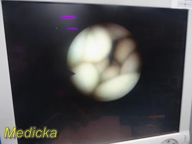 Rinocerontescopio Flexible Karl Storz 11001H con Estuche OF-S1 ETO Tapa PROBADO ~ 37994 Foto 3 de 4