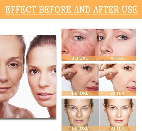 Glycolic Acid Toning Solution, Glycolic Acid 7% Toner - Picture 4 of 7