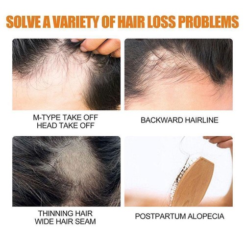 100ml Hair Growth Spray 5 % Mino xidil For Men Women Regrowth Hair-- J9E9 - Picture 4 of 12