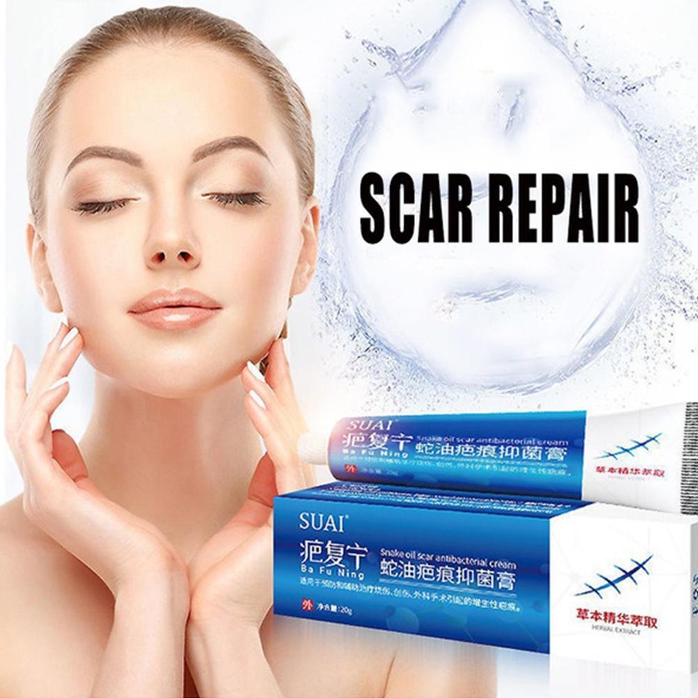 Scar Removal Cream Repairing Burn Scratch Pimples Scars For All Skin eBay