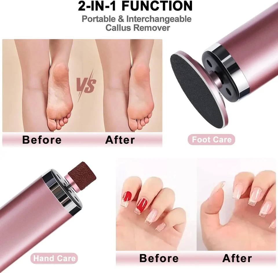 Removedor eléctrico de callos para pies lima de pies herramienta de pedicura inalámbrica potente Foto 2 de 4