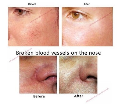 egyptian magic rosacea
