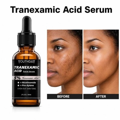 TRANEXAMIC ACID RADIANCE BRIGHTENING SERUM 30ML GENUINE NEW!!!