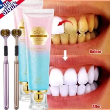 Niacinamide Whitening Toothpaste,Natural Niacinamide Toothpaste,Teeth Whitening