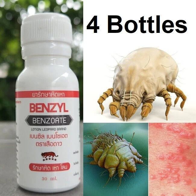 Scabies treatment cheap