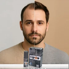 Minoxidil Hair Growth Spray for Men 5% Advanced Hair Regrowth Treatment. Hi- Gro