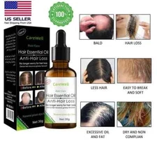 Organic Hair Essential Oil Growth Essence Anti Hair Loss All Natural treatment
