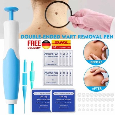 2026 Stielwarzen Entferner,Skin Tag Entferner,2in1 Stielwarzen Entfernen schnell