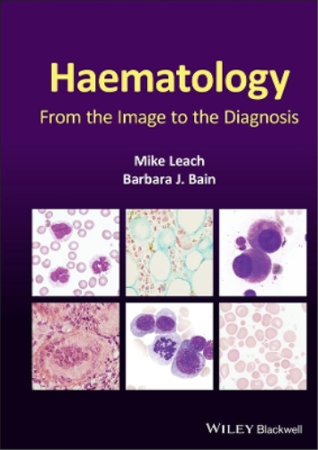Mike Leach Barbara J. Bain Haematology (Copertina rigida)