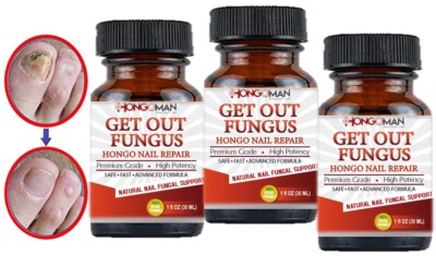 Hongo Nail Repair 3 Bottles | Antifungal Nail Oil | Natural Fungus Support