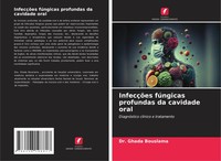 InfecçõEs FúNgicas Profundas Da Cavidade Oral DiagnóStico ClíNico E Tratamento