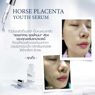 EVE'S HORSE PLACENTA YOUTH SERUM 15 ml. Whitening & Reduce