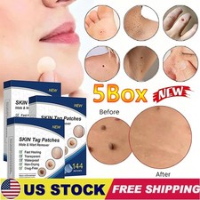 720pc Skin Tag Remover Patches Quick Effective Mole and Wart Pad Removal Sticker