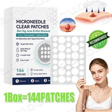 2026 NEW Curalona Microneedle Patches 144pcs, Skin Tag Wart Acne Remover Patches