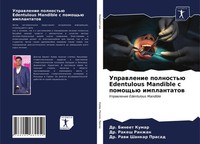 Bineet Kumar (U. A.) | Uprawlenie Polnost'ü Edentulous Mandible S Pomosch'ü...