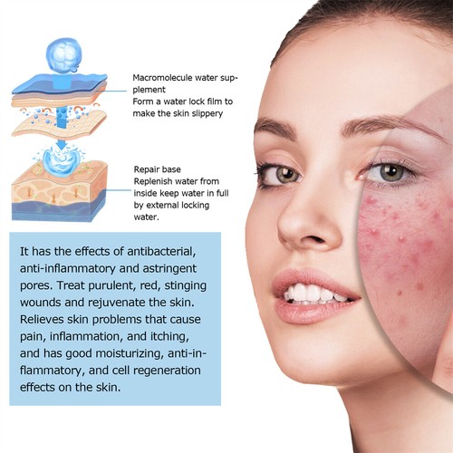 Glamory Micro Infusion System for Face Lips Keep hydrated and Refreshed. - Picture 5 of 28