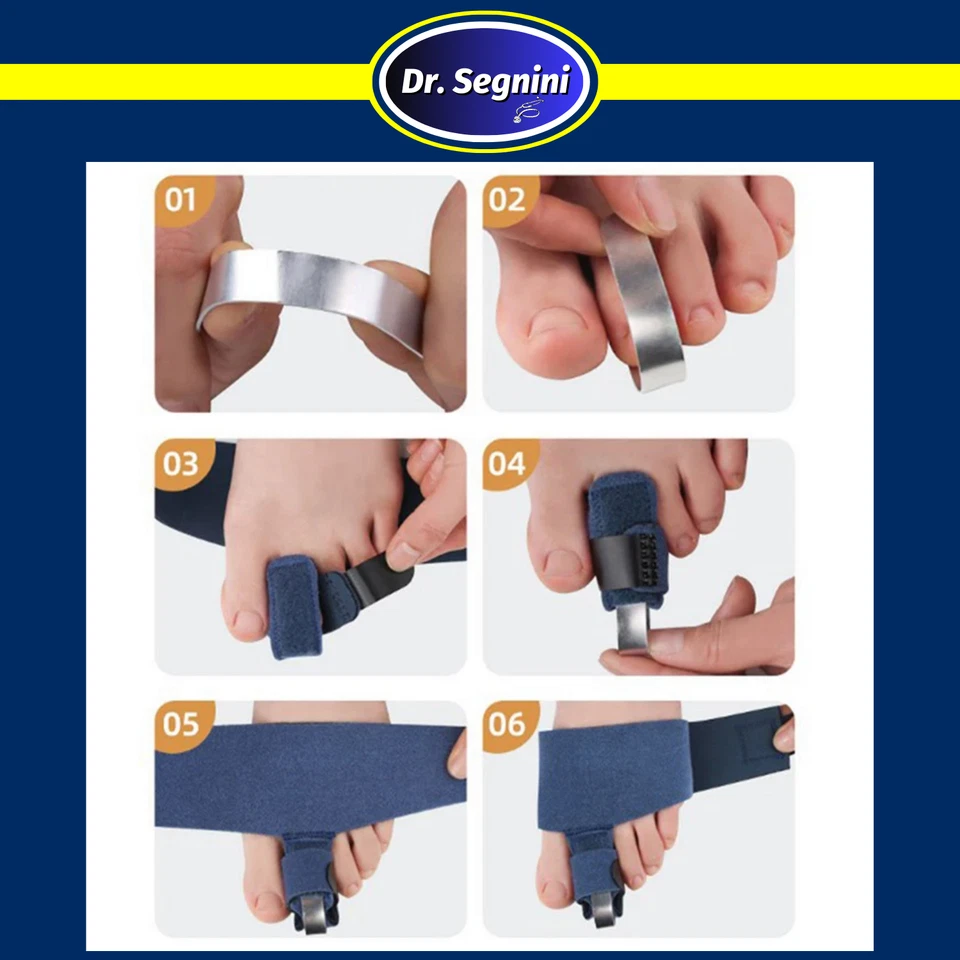 1件装脚趾矫正器可调节夹板矫直器支撑 — 第 4/4 张图片