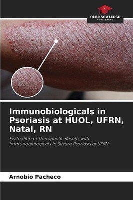Immunobiologicals in Psoriasis at HUOL, UFRN, Natal, RN by Arn?bio Pach?co Paper