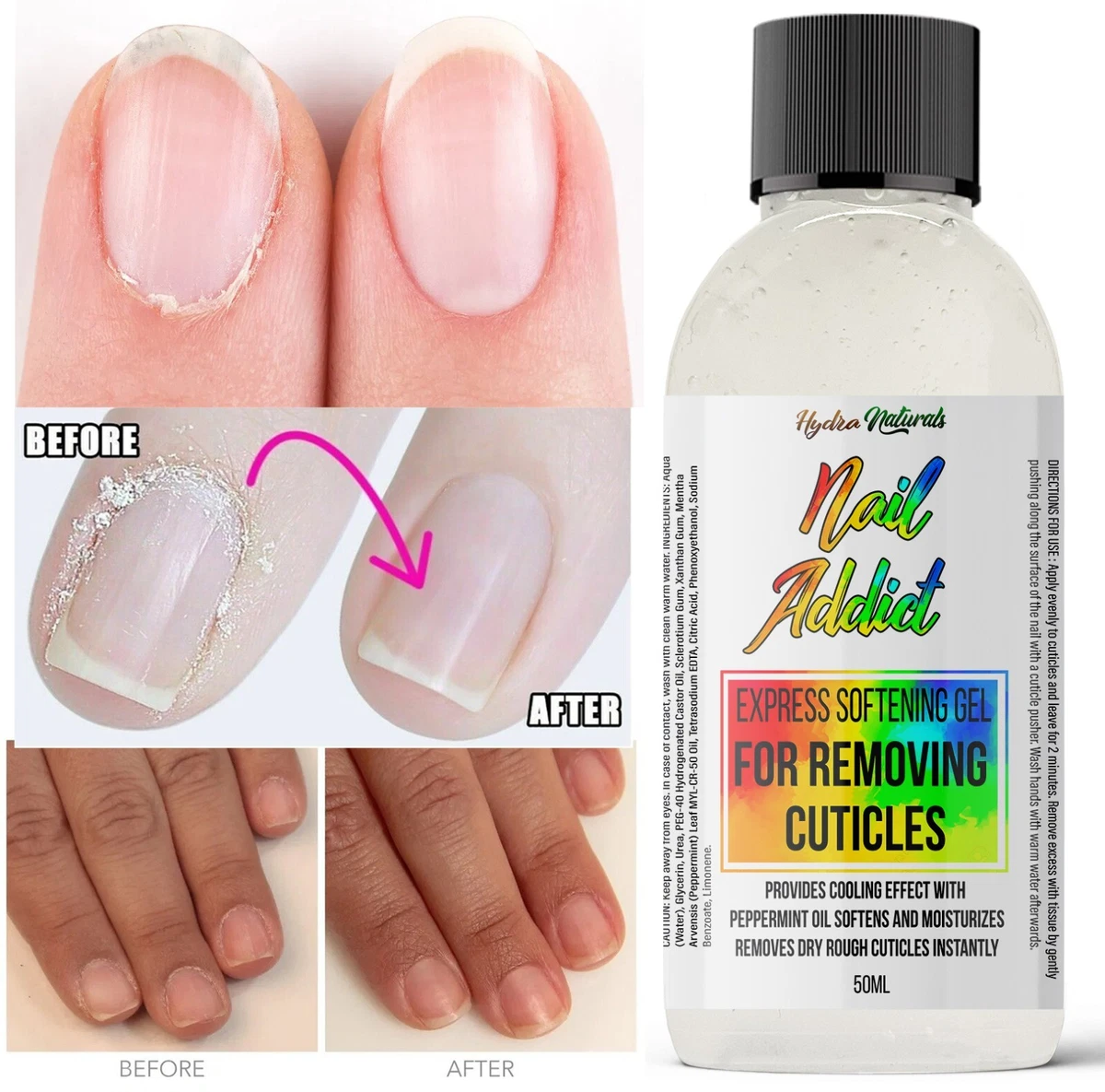 Details 148+ nail therapy remover super hot noithatsi.vn