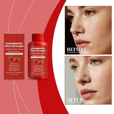 Strawberry Skin Hyperpigmentation Cream, Skin Lightening and Bleaching Cream
