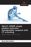 99Mtc Hmdp Einzelphotonen-Emissions-Tomographie Gekoppelt Mit Ct-Scanning: