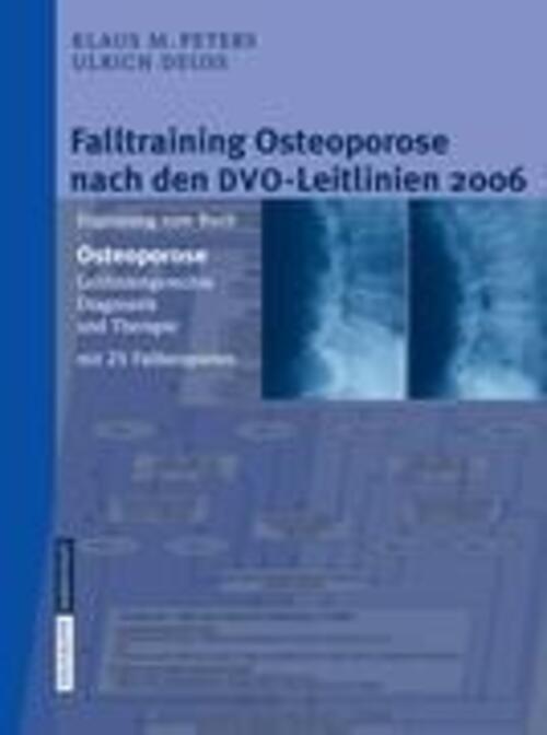 Ulrich Deuß (u. A.) | Falltraining Osteoporose Nach Den Dvo-leitlinien