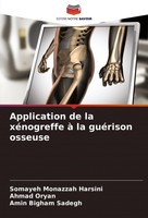 Application De La XéNogreffe à La GuéRison Osseuse Somayeh Monazzah Harsini
