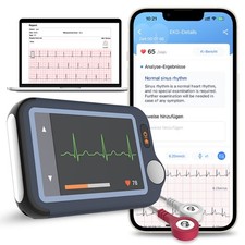 Checkme EX EKG Gerät mit KI-Analysefunktion, 30s/ 60s/5min Messzeit mit App & PC