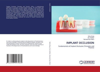 IMPLANT OCCLUSION Neha Ahuja