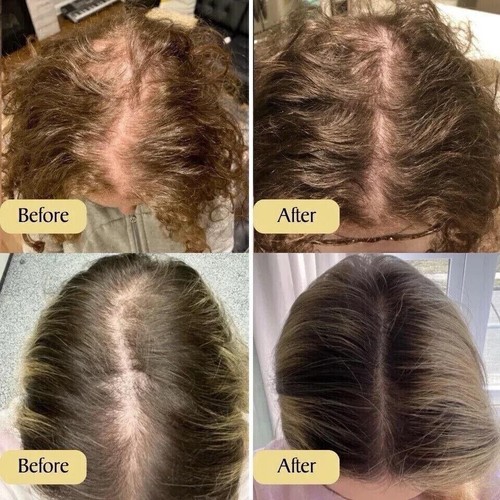1-5x Natural Hair Growth Oil, Veganic Natural Hair Growth Oil Hair Care 60ml AU - Picture 7 of 8