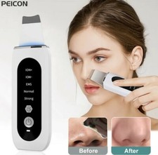 Ultraschallpeelinggerät Porenreiniger Gesichts Ultraschall Peeling Skin Scrubber