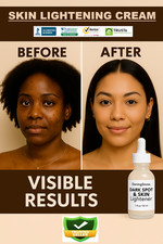 Skin Lightening Cream   Dark Spot Corrector Brightening Serum for Face  Body