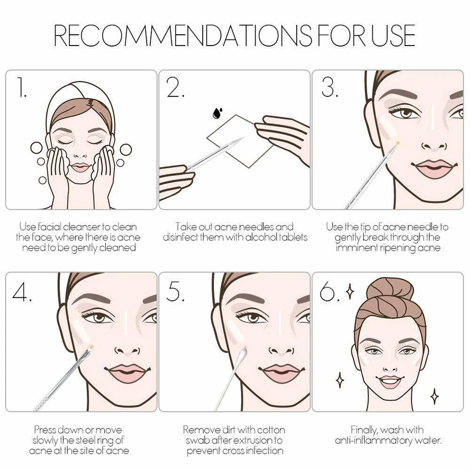 Kit de herramientas removedor de espinillas Pimple Popper comedón herramientas extractor de manchas de acné - Imagen 2 de 4
