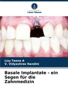 Lizy Teena A (U. A.) | Basale Implantate - Ein Segen FüR Die Zahnmedizin | Buch