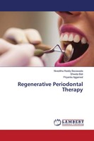 Regenerative Periodontal Therapy Niveditha Reddy Bezawada (U. A.) Taschenbuch